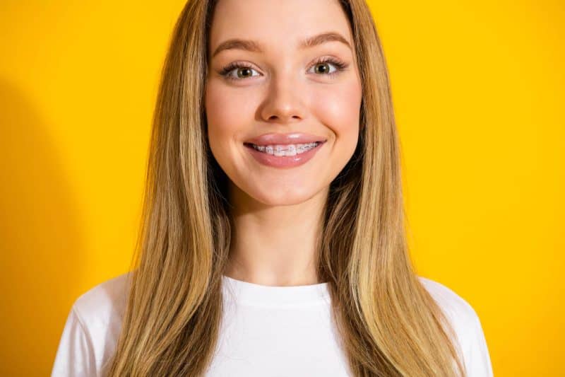 Adult Orthodontics in South Jordan